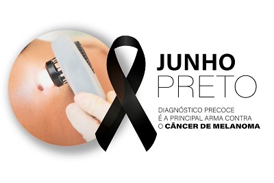 Diagn&oacute;stico precoce &eacute; a principal arma contra o tipo mais agressivo de c&acirc;ncer de pele